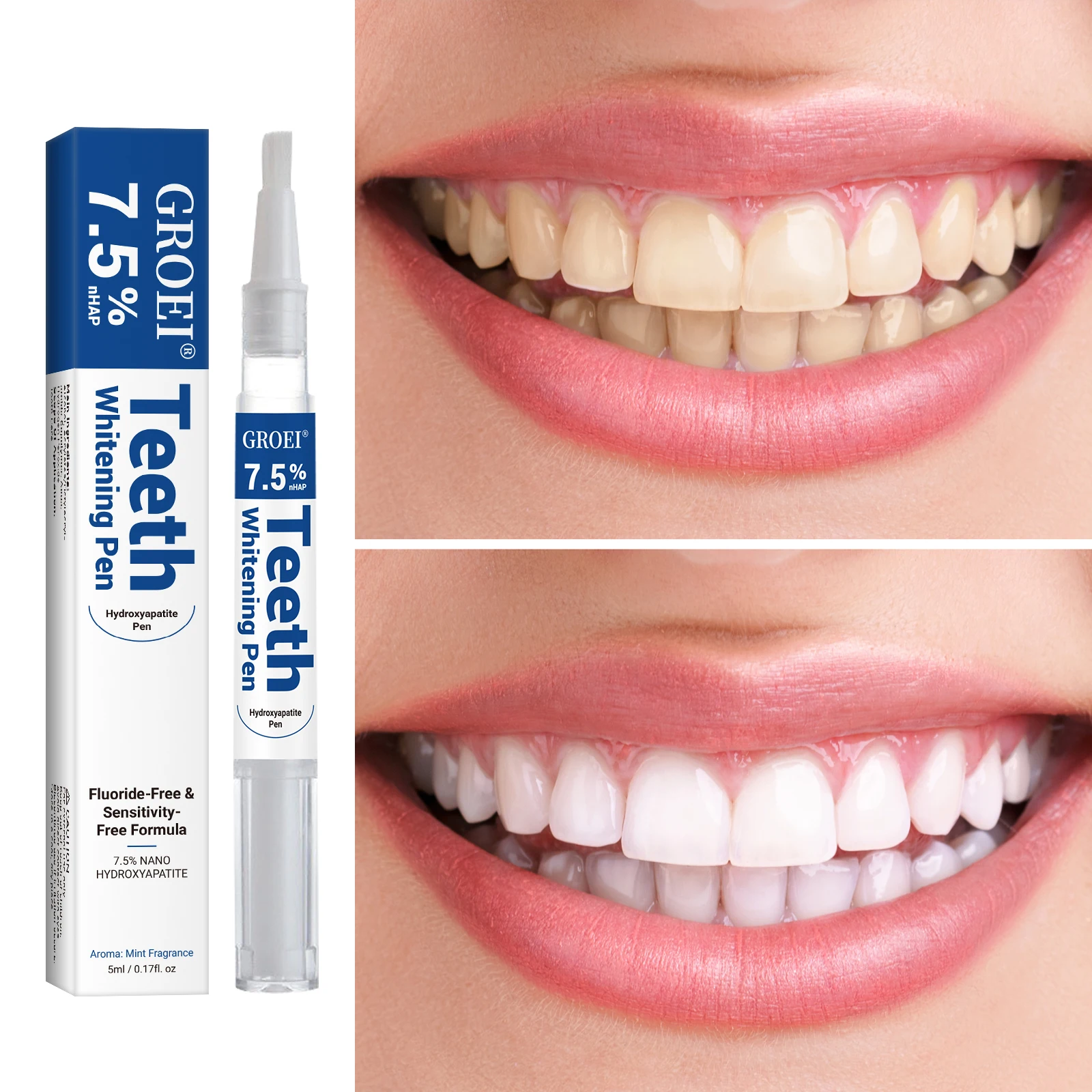 Hydroxyapatite Tooth Whitening - đánh giá và giá Teeth Whitening Hydrogen Peroxide