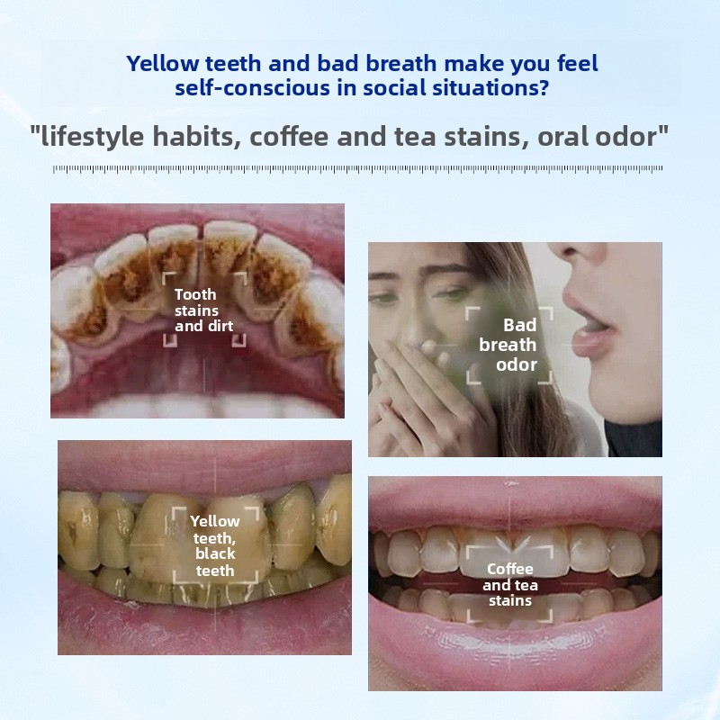 Enzyme Brightening and Whiteni - đánh giá và giá Teeth Whitening Enzymes