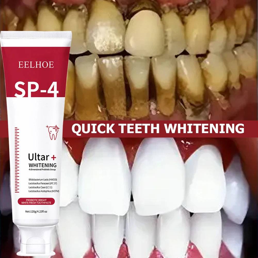 5pcs Sp-4 120g Probiotic White - đánh giá và giá Teeth Whitening Enzymes