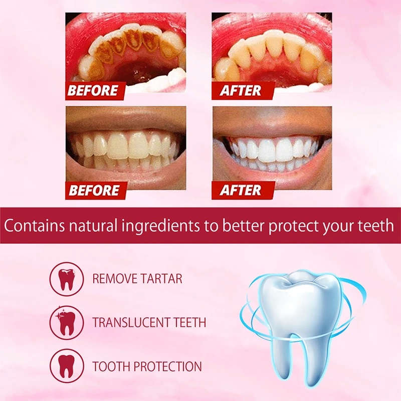 SP-4 Probiotic Whitening Tooth - đánh giá và giá Teeth Whitening Enzymes